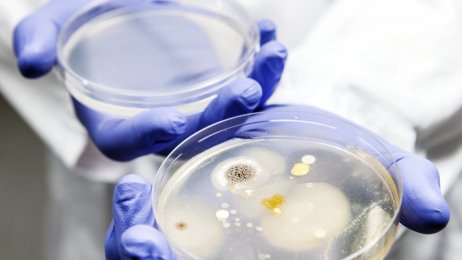 Petridisker med bakterievekster. Bildet viser petridisker med bakterievekster.