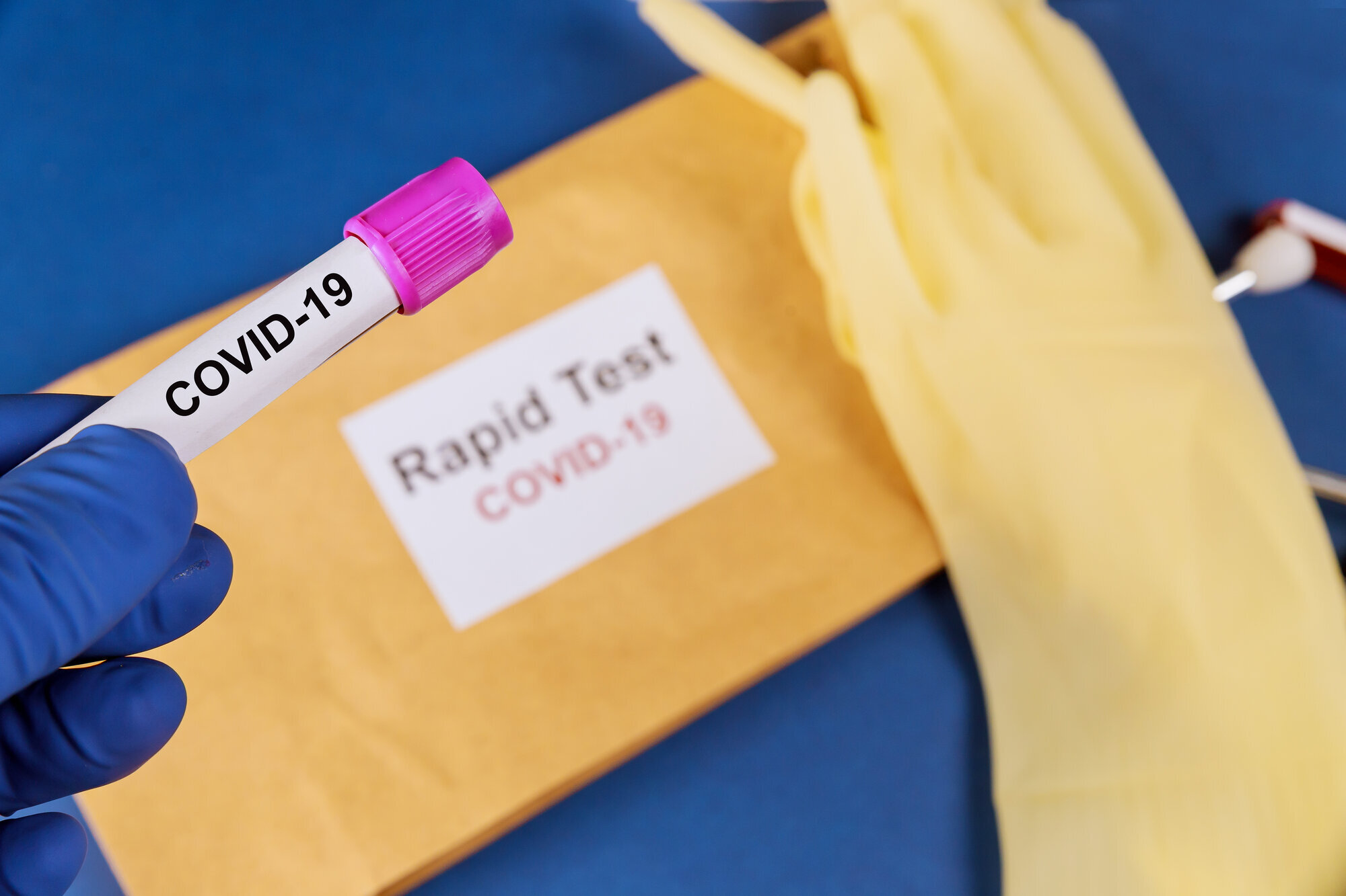 Koronavirus Viser en covid-19 hurtigtest
