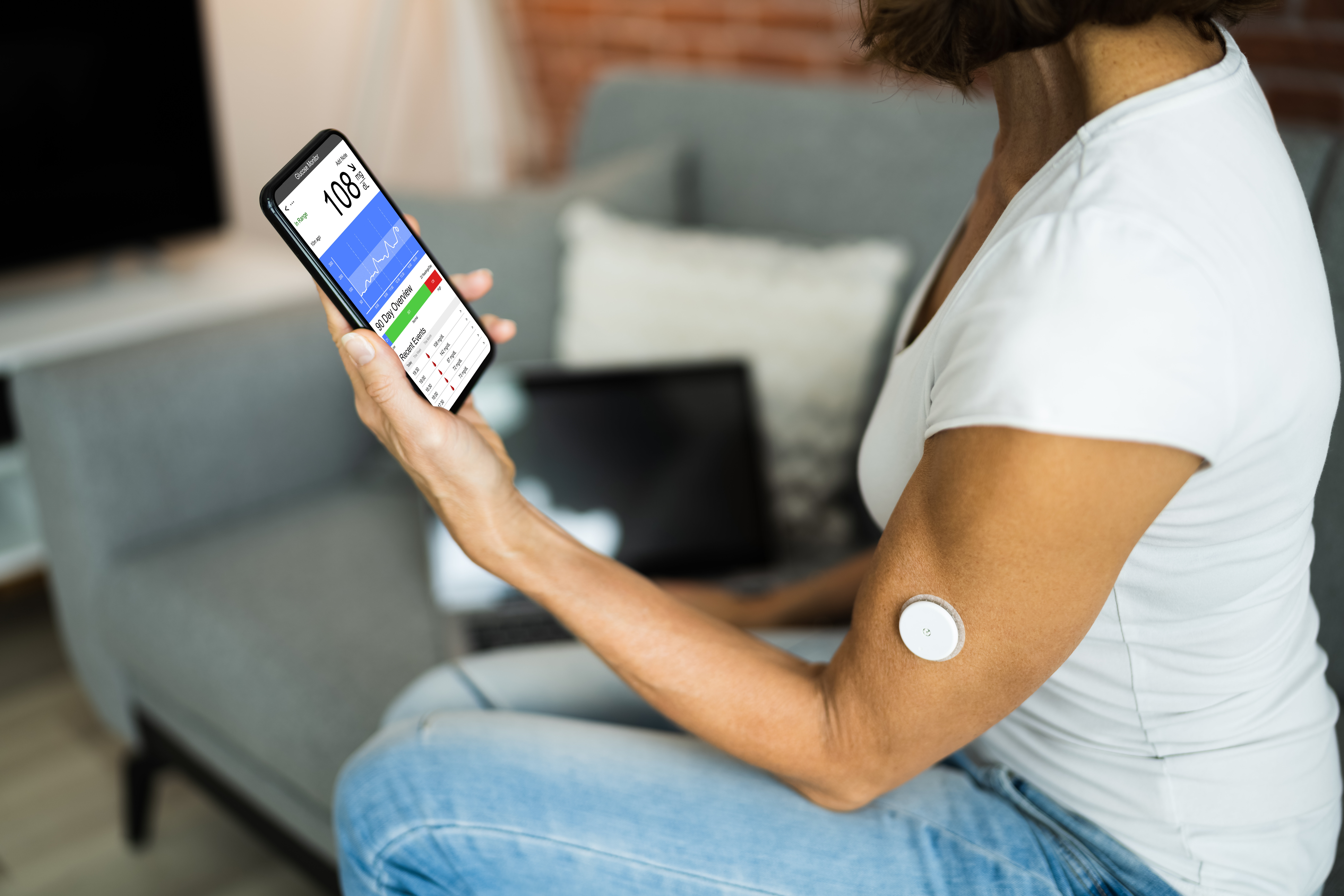 CGM (kontinuerlig glukosemåling) Bildet viser en kvinnelig pasient som bruker CGM (kontinuerlig glukosemåling) for å måle blodsukkeret. Verdiene sendes via bluetooth til mobilen.