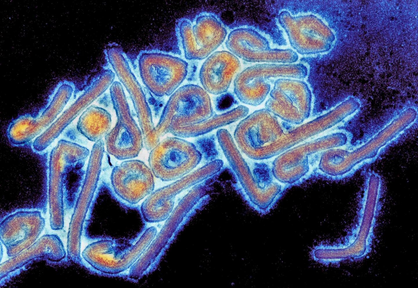 Marburgvirus Bildet viser et mikrofotografi av et marburgvirus