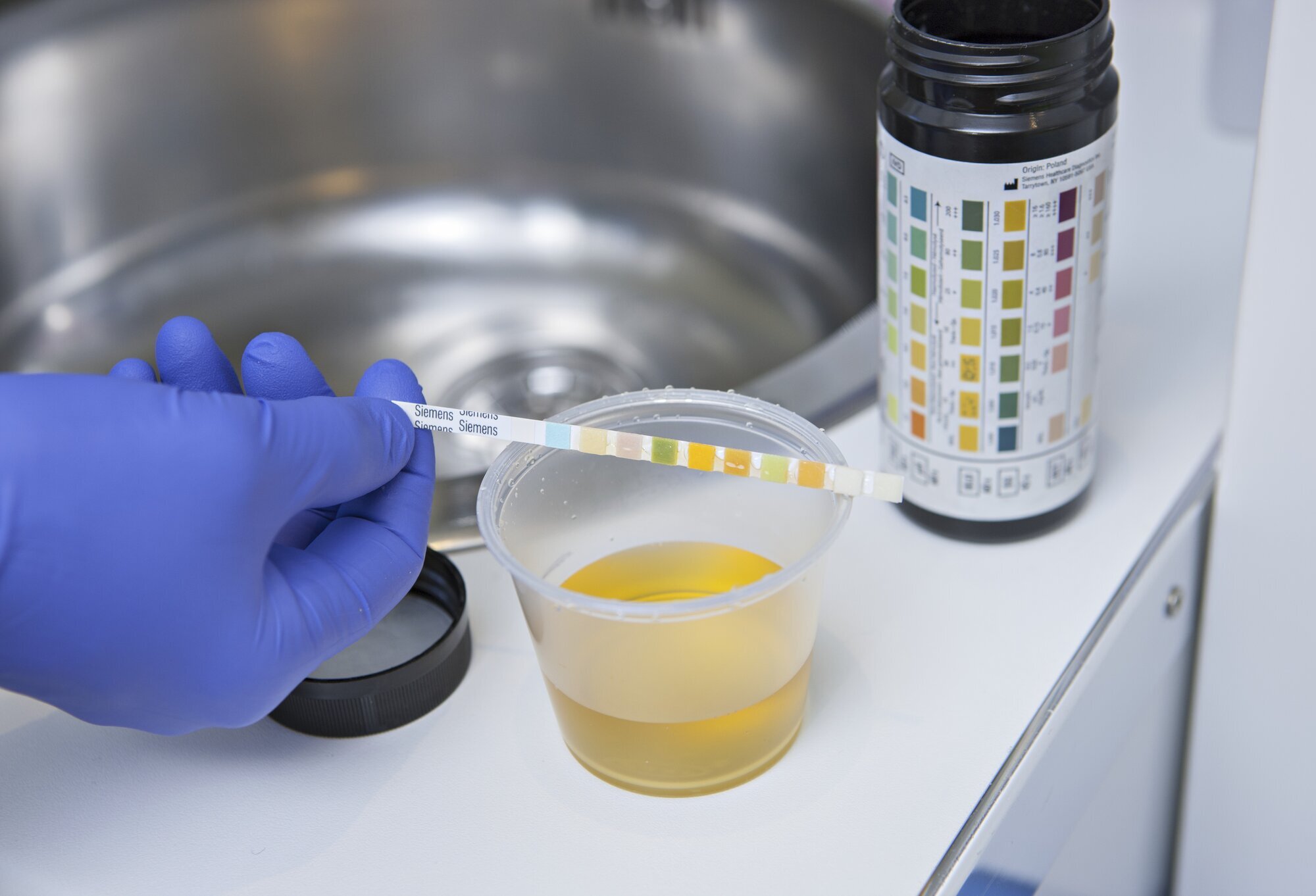 urin, prøve, urinstix Bildet viser et prøveglass med urin og en strimmel med urinstix.