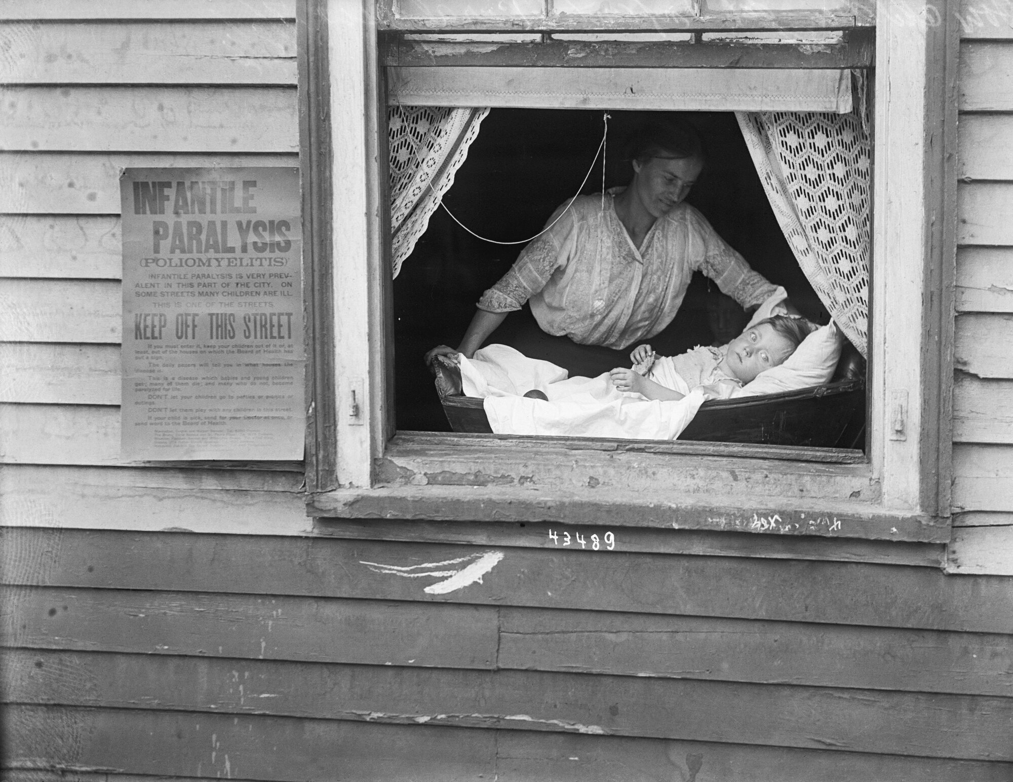 En kvinne og et barn under polioepidemien i USA i 1916. Bildet viser kvinne og barn i et vindu under polioepidemien i USA i 1916.