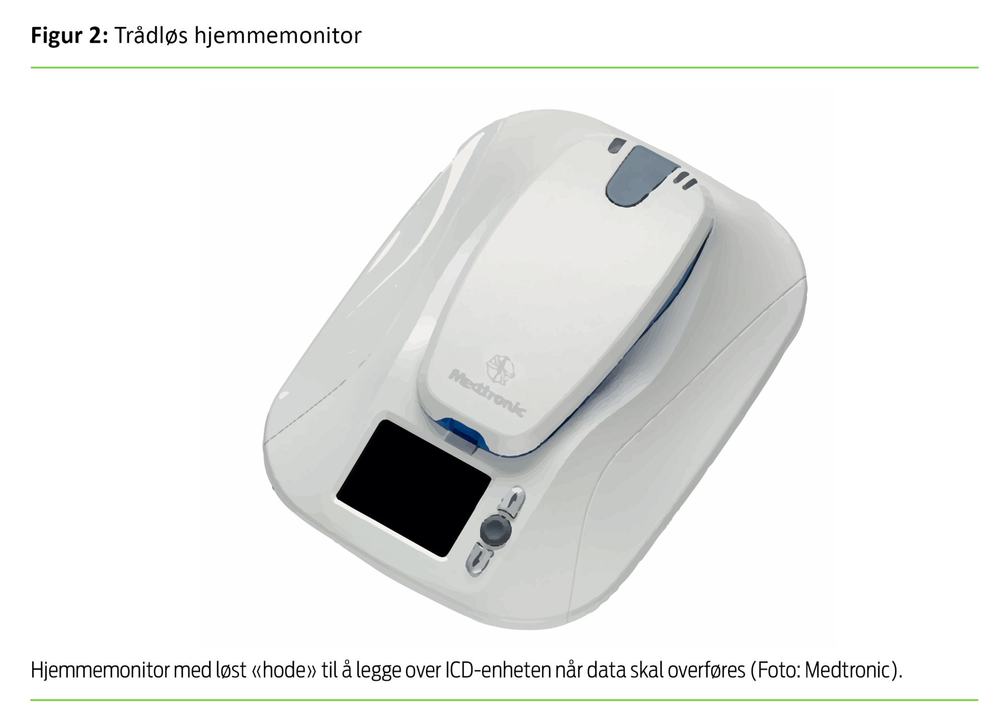 Figur 2 Figur 2. Trådløs hjemmemonitor