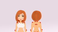 Fibromyalgi, ømme punkter Fibromyalgi, ømme punkter