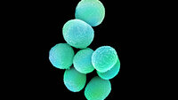 MRSA (meticillinresistente gule stafylokokker) Bildet viser MRSA (meticillinresistente gule stafylokokker).