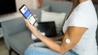 CGM (kontinuerlig glukosemåling) Bildet viser en kvinnelig pasient som bruker CGM (kontinuerlig glukosemåling) for å måle blodsukkeret. Verdiene sendes via bluetooth til mobilen.
