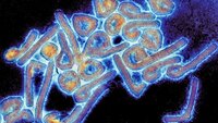 Marburgvirus Bildet viser et mikrofotografi av et marburgvirus