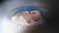 Søvndybde ved keisersnitt Fotomontasjen viser en baby tatt med keisersnitt, som skimtes gjennom et øye.