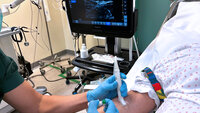 ultrasound-guided PVC The photo shows a nurse using ultrasound to locate a vein before catheterisation