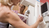 mammografiscreening bildet viser mammografiscreening