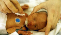 Prematur Prematurt barn som stelles i kuvøse