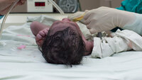Bilde av en nyfødt prematur baby. Bilde av en nyfødt prematur baby.